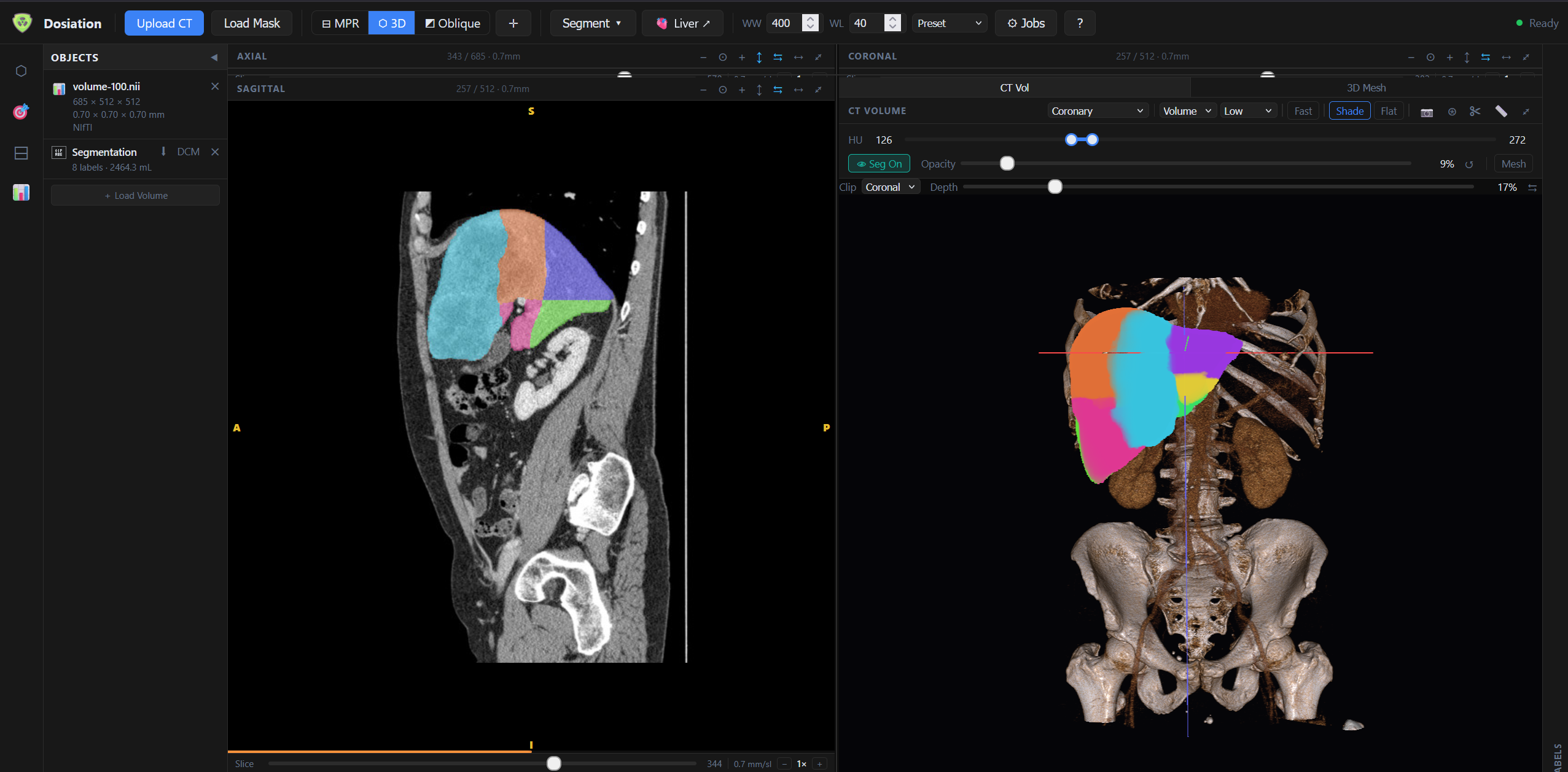 3D volumetric render with segments overlaid on CT volume and skeleton